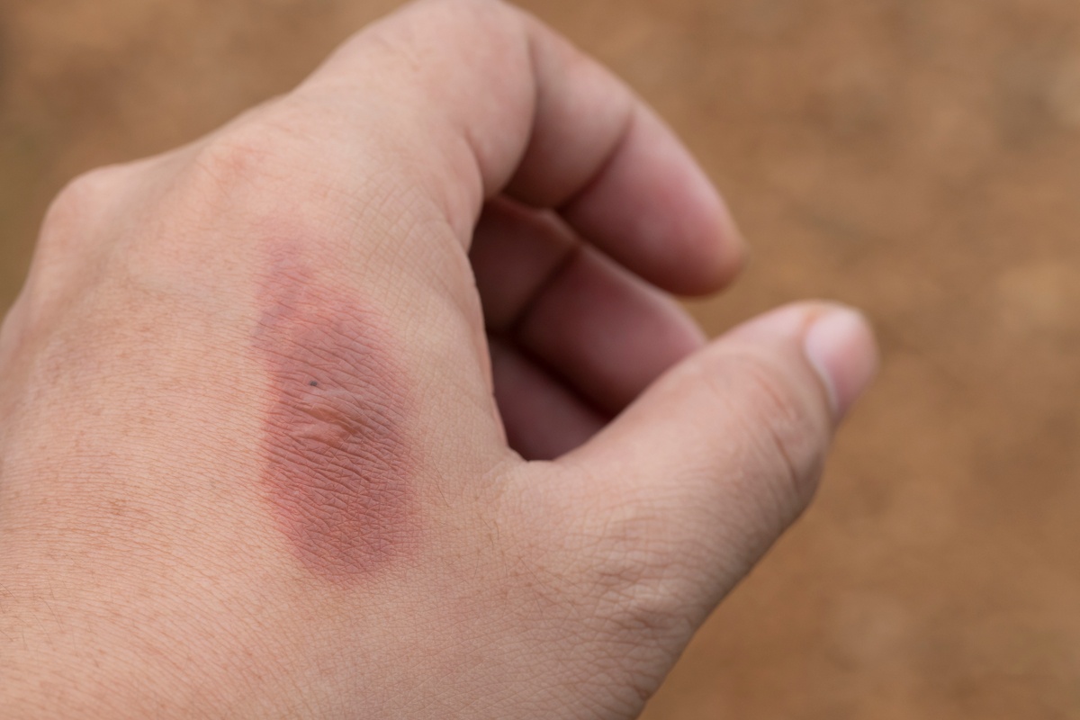 DRB_27NOV2020_VV_Burn1